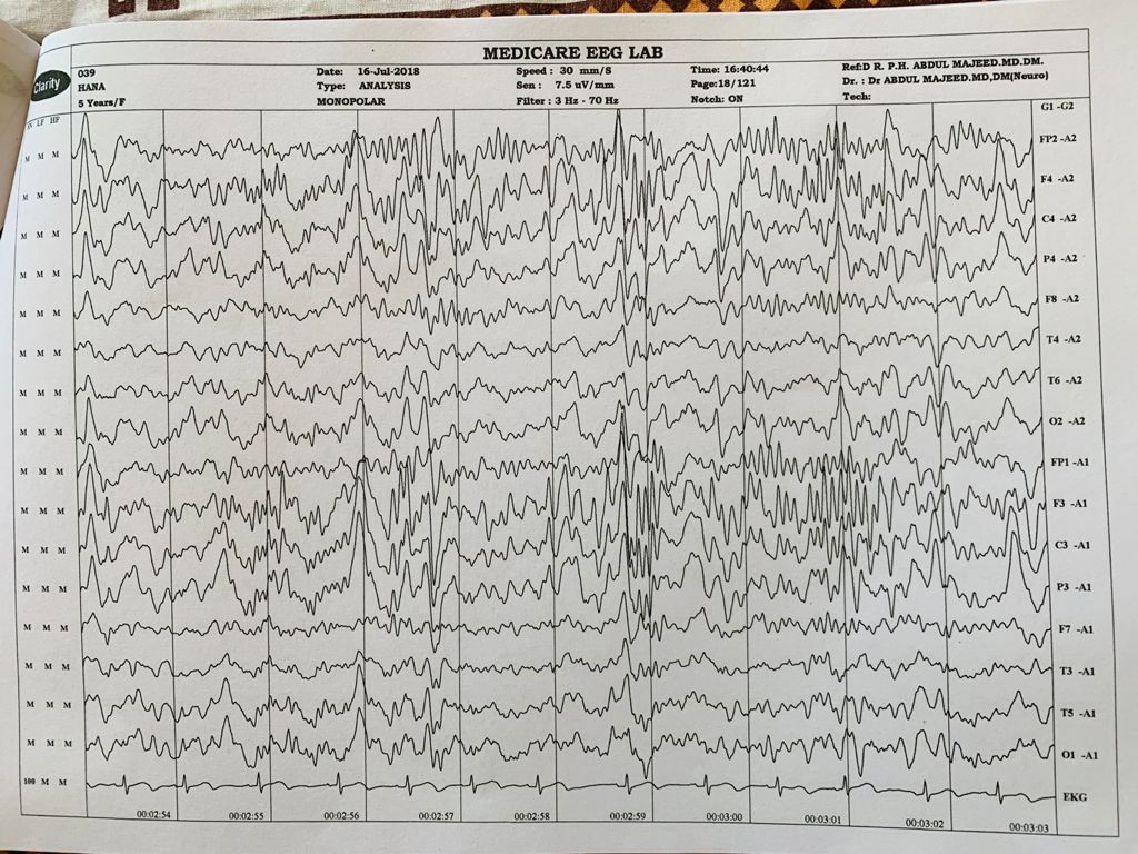 Patient Story